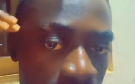 Movie actor Lil Win displays the effects of the May 25 vehicle accident