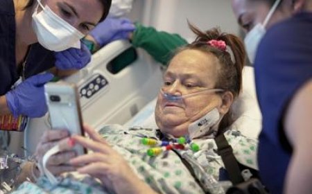 Woman who received pig kidney transplant and mechanical heart pump dies