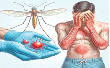 Dengue Fever outbreak: What you need to know to stay safe