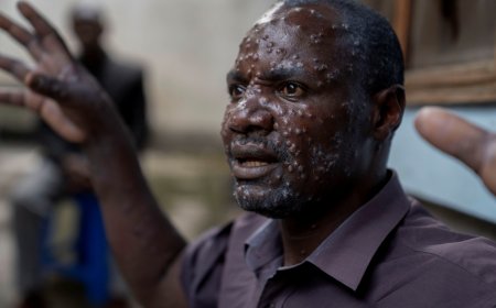 WHO set to convene specialists amid growing monkeypox cases across Africa.
