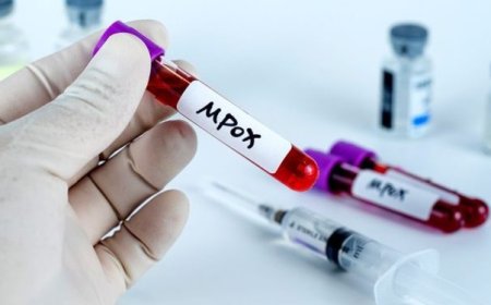 GHS Reports Seven New Mpox Cases as Outbreak Reaches 170