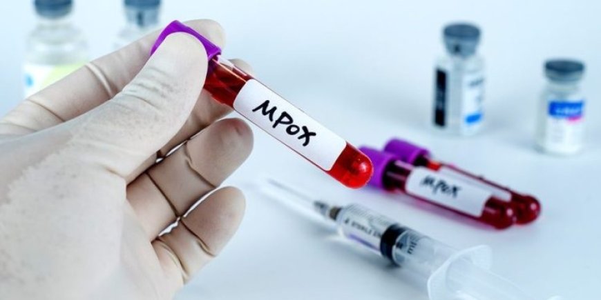 GHS Reports Seven New Mpox Cases as Outbreak Reaches 170