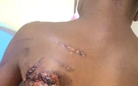 Mother Accused of Burning Son with Pressing Iron Over Lost Pen Faces Court   