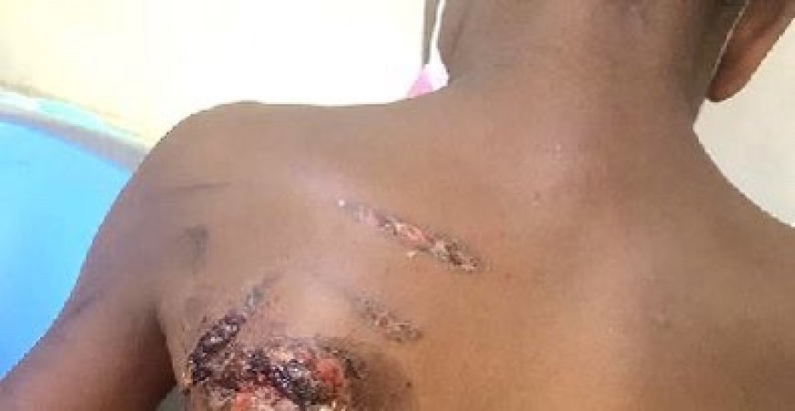 Mother Accused of Burning Son with Pressing Iron Over Lost Pen Faces Court   