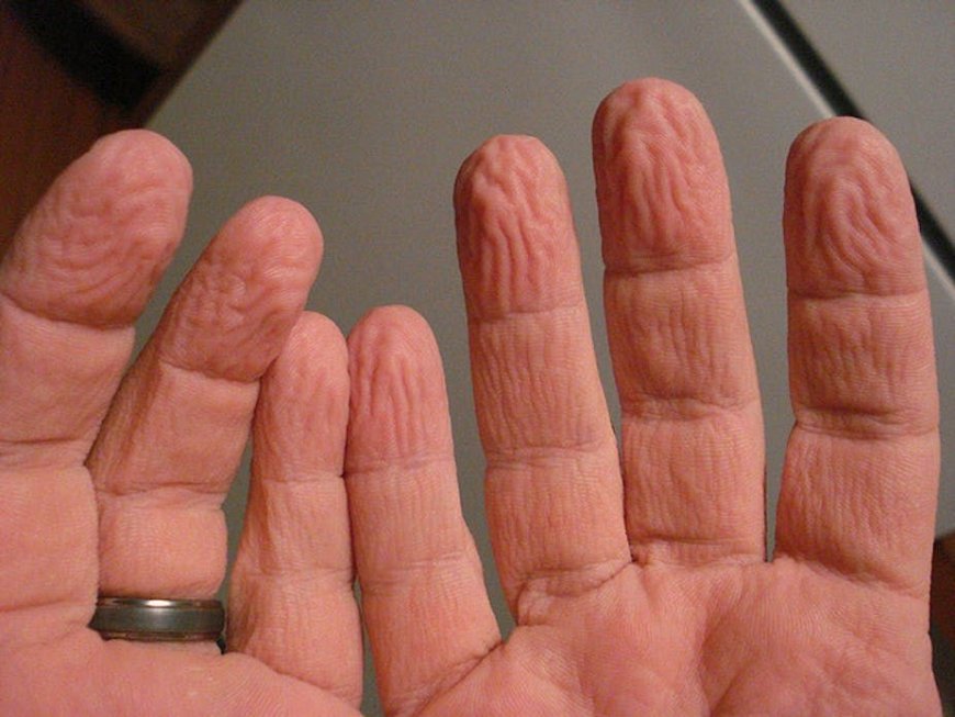 The Science Behind Wrinkled Fingers: Debunking the Myth